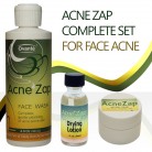 Ovante Acne Zap Daily Regimen, Complete Kit With Medicated Face Wash, Drying Lotion for Spot Treatment, Natural Sulfur Cream - Complete Set of Acne Products